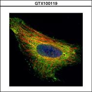 Confocal immunofluorescence analysis (Olympus FV10i) of paraformaldehyde-fixed HeLa, using TIP30 antibody (Green) at 1:500 dilution. Alpha-tubulin filaments were labeled with alpha-tubulin antibody (Red) at 1:2000.
