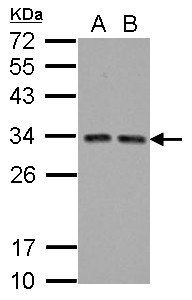 Sample (30 ug of whole cell lysate) A: A431 B: HeLa 12% SDS PAGE HTATIP2 / TIP30 antibody diluted at 1:5000