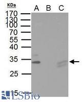 IP Sample: hela whole cell lysate/extract A. 40 µg hela whole cell lysate/extract B. Control with 2 µg of preimmune rabbit IgG C. Immunoprecipitation of TIP30 protein by 2 µg of TIP30 antibody 10% SDS-PAGE The immunoprecipitated TIP30 protein was detected by TIP30 antibody diluted at 1:1000.
