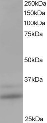 Antibody staining (1 ug/ml) of Human Lung lysate (RIPA buffer, 35 ug total protein per lane). Primary incubated for 1 hour. Detected by Western blot of chemiluminescence.