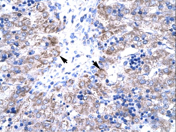 HTATIP2 / TIP30 antibody LS-C30651 was used in IHC to stain formalin-fixed, paraffin-embedded human liver.