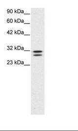 Jurkat Cell Lysate