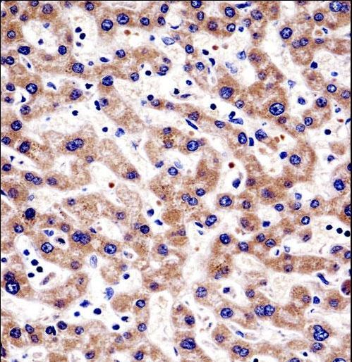 HTATIP2 Antibody immunohistochemistry of formalin-fixed and paraffin-embedded human liver tissue followed by peroxidase-conjugated secondary antibody and DAB staining.