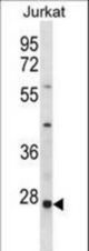 HTATIP2 Antibody western blot of Jurkat cell line lysates (35 ug/lane). The HTATIP2 antibody detected the HTATIP2 protein (arrow).