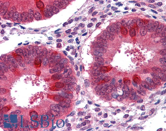 Anti-RUVBL2 antibody IHC of human uterus. Immunohistochemistry of formalin-fixed, paraffin-embedded tissue after heat-induced antigen retrieval. Antibody LS-B4213 concentration 10 ug/ml.