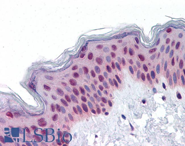 Anti-RUVBL2 antibody IHC of human skin. Immunohistochemistry of formalin-fixed, paraffin-embedded tissue after heat-induced antigen retrieval. Antibody LS-B4213 concentration 10 ug/ml.