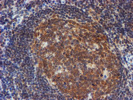 IHC of paraffin-embedded Human tonsil using anti-RUVBL2 mouse monoclonal antibody.