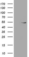 HEK293T cells were transfected with the pCMV6-ENTRY control (Left lane) or pCMV6-ENTRY RUVBL2 (Right lane) cDNA for 48 hrs and lysed. Equivalent amounts of cell lysates (5 ug per lane) were separated by SDS-PAGE and immunoblotted with anti-RUVBL2.