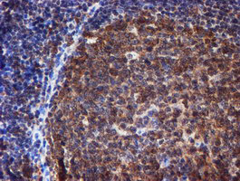 IHC of paraffin-embedded Human tonsil using anti-RUVBL2 mouse monoclonal antibody.