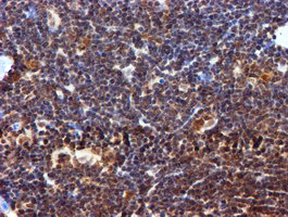 IHC of paraffin-embedded Human lymphoma tissue using anti-RUVBL2 mouse monoclonal antibody.