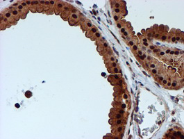 IHC of paraffin-embedded Human breast tissue using anti-RUVBL2 mouse monoclonal antibody.