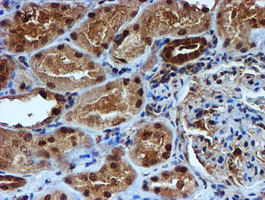 IHC of paraffin-embedded Human Kidney tissue using anti-RUVBL2 mouse monoclonal antibody.