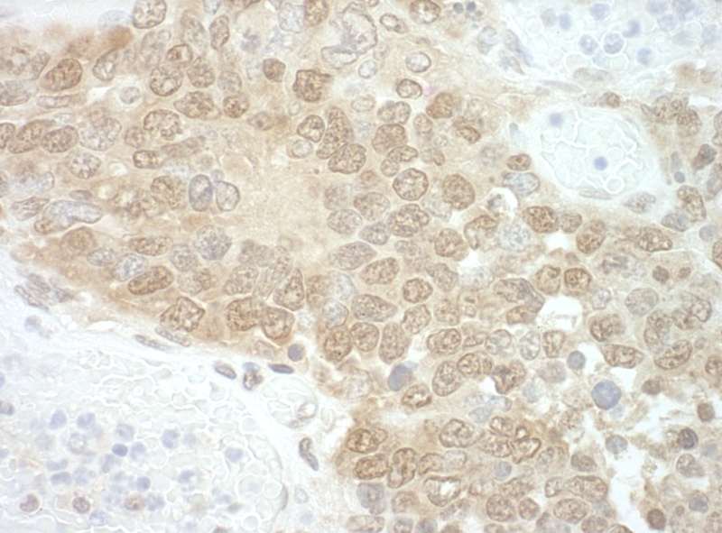 Detection of Mouse RuvBL2 by Immunohistochemistry. Sample: FFPE section of mouse teratoma. Antibody: Affinity purified rabbit anti-RuvBL2 used at a dilution of 1:250.