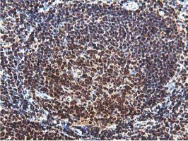 IHC of paraffin-embedded Human tonsil using anti-RUVBL2 mouse monoclonal antibody.