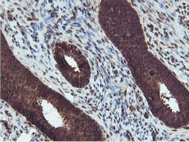 IHC of paraffin-embedded Human endometrium tissue using anti-RUVBL2 mouse monoclonal antibody.
