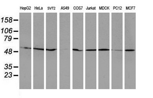 Western blot of extracts (35 ug) from 9 different cell lines by using anti-RUVBL2 monoclonal antibody.