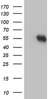 HEK293T cells were transfected with the pCMV6-ENTRY control (Left lane) or pCMV6-ENTRY RUVBL2 (Right lane) cDNA for 48 hrs and lysed. Equivalent amounts of cell lysates (5 ug per lane) were separated by SDS-PAGE and immunoblotted with anti-RUVBL2.