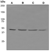 Western blot analysis on (A) HepG2, (B) Daudi, (C) HeLa, and (D) SKBR-3 cell lysates using anti-RUVBL2 antibody.