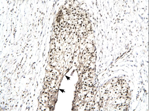 Human Urinary bladder