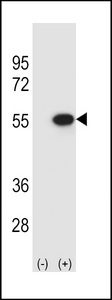 Western blot of RUVBL2 (arrow) using rabbit polyclonal RUVBL2 Antibody. 293 cell lysates (2 ug/lane) either nontransfected (Lane 1) or transiently transfected (Lane 2) with the RUVBL2 gene.