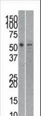 The anti-RUVBL21 antibody is used in Western blot to detect RUVBL2 in mouse kidney (left) and SK-Br-3 (right) tissue/cell line lysates.