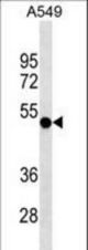 RUVBL1 Antibody western blot of A549 cell line lysates (35 ug/lane). The RUVBL1 antibody detected the RUVBL1 protein (arrow).