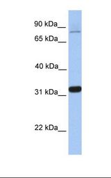 Fetal heart lysate. Antibody concentration: 1.0 ug/ml. Gel concentration: 12%.