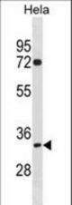 TIPIN Antibody western blot of HeLa cell line lysates (35 ug/lane). The TIPIN antibody detected the TIPIN protein (arrow).