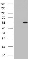 HEK293T cells were transfected with the pCMV6-ENTRY control (Left lane) or pCMV6-ENTRY TIPIN (Right lane) cDNA for 48 hrs and lysed. Equivalent amounts of cell lysates (5 ug per lane) were separated by SDS-PAGE and immunoblotted with anti-TIPIN.