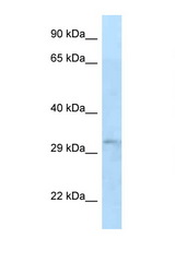 TIPRL antibody LS-C145675 Western blot of 721_B Cell lysate. Antibody concentration 1 ug/ml.