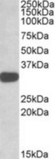 TIPRL antibody (1 ug/ml) staining of K562 lysate (35 ug protein/ml in RIPA buffer). Primary incubation was 1 hour. Detected by chemiluminescence.