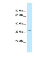 Western blot of Human THP-1. TIPRL antibody dilution 1.0 ug/ml.