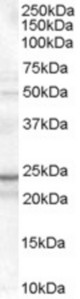 Antibody (0.1 ug/ml) staining of K562 cell lysate (35 ug protein in RIPA buffer). Primary incubation was 1 hour. Detected by chemiluminescence.