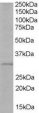Antibody (1 ug/ml) staining of Human Liver lysate (35 ug protein in RIPA buffer). Primary incubation was 1 hour. Detected by chemiluminescence.