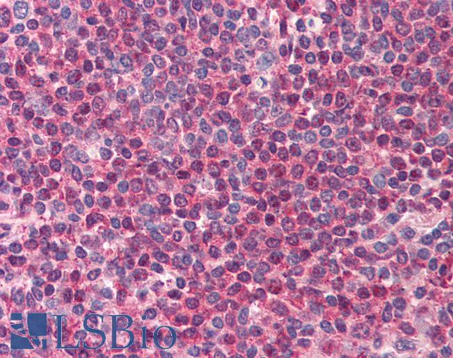 Anti-TIRAP antibody IHC of human spleen. Immunohistochemistry of formalin-fixed, paraffin-embedded tissue after heat-induced antigen retrieval. Antibody LS-B599 concentration 5 ug/ml.