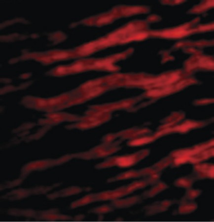 Immunofluorescence of TIRAP in Human Heart cells with TIRAP antibody at 20 ug/ml.