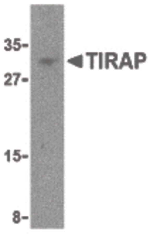 Western blot of TIRAP in MCF-7 cell lysate with TIRAP antibody at 4 ug/ml.