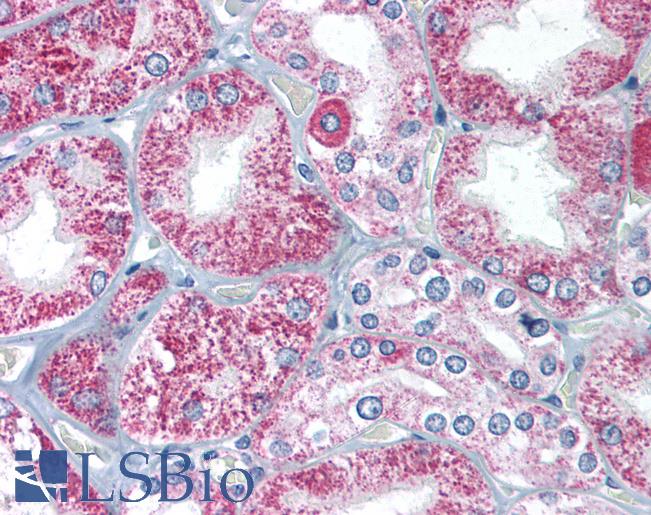 Anti-TIRAP antibody IHC of human kidney. Immunohistochemistry of formalin-fixed, paraffin-embedded tissue after heat-induced antigen retrieval. Antibody LS-B1414 concentration 2 ug/ml.