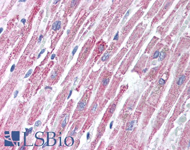 Anti-TIRAP antibody IHC of human heart. Immunohistochemistry of formalin-fixed, paraffin-embedded tissue after heat-induced antigen retrieval. Antibody LS-B1414 concentration 2 ug/ml.
