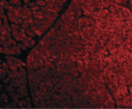 Immunofluorescence of TIRAP in Human Heart cells with TIRAP antibody at 10 ug/ml.
