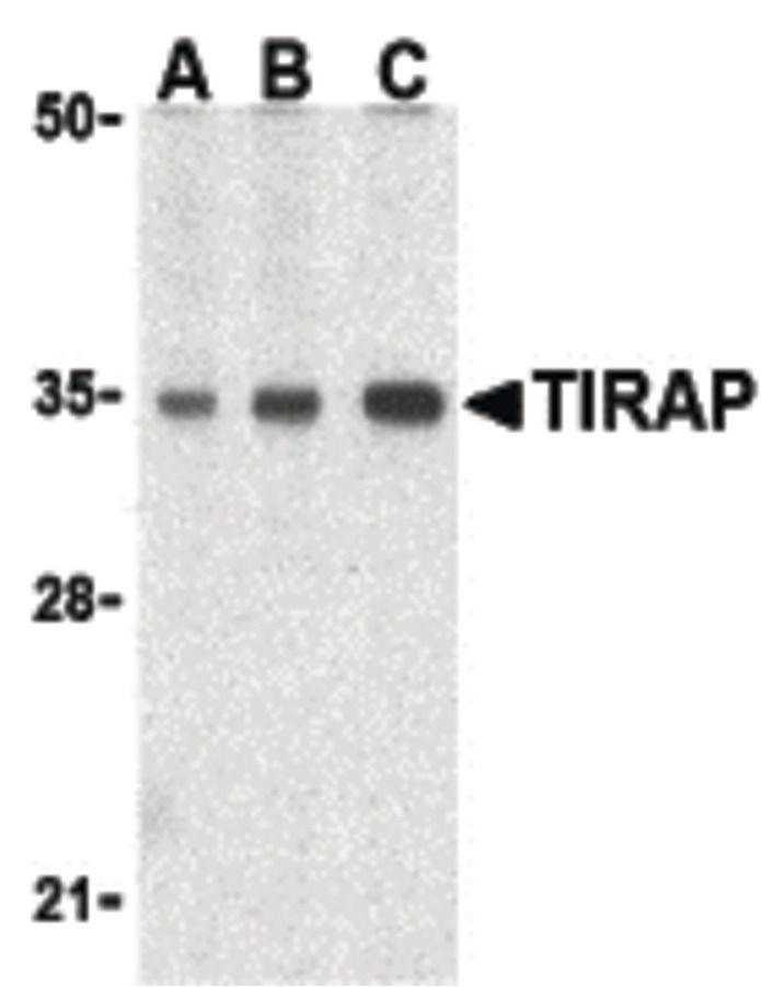 Western blot of TIRAP in human heart cell lysates with TIRAP antibody at (A) 0.5, (B) 1, and (C) 2 ug/ml.