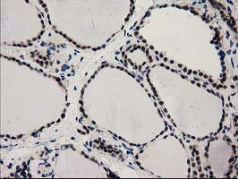 IHC of paraffin-embedded Human thyroid tissue using anti-PYCRL mouse monoclonal antibody.