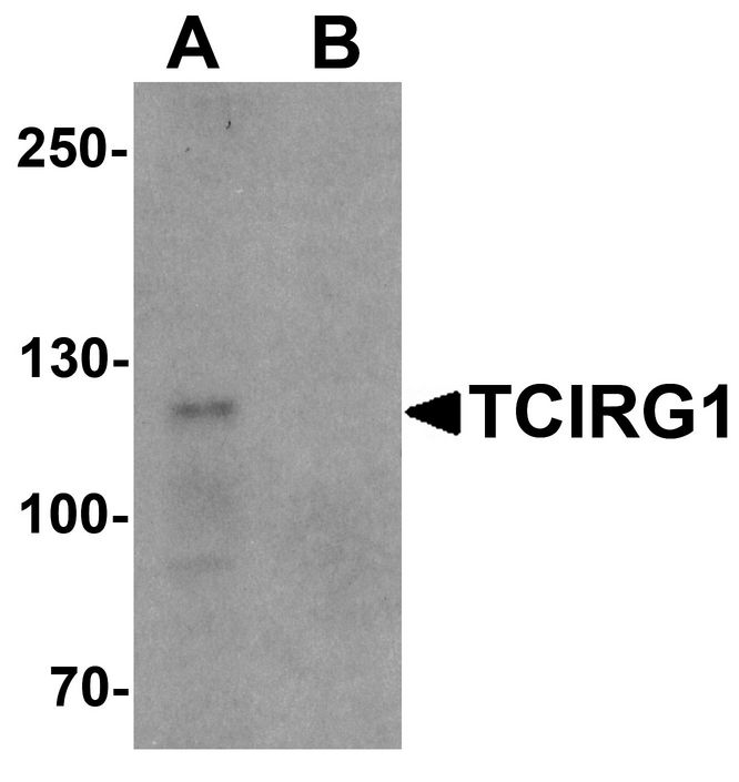 Western blot analysis of TCIRG1 in EL4 cell lysate with TCIRG1 antibody at 0.5 ug/ml in (A) the absence and (B) the presence of blocking peptide.