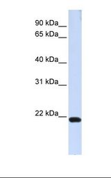 293T cell lysate. Antibody concentration: 1.0 ug/ml. Gel concentration: 12%.