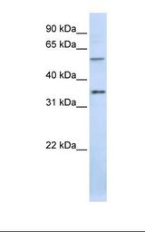Placenta lysate. Antibody concentration: 1.0 ug/ml. Gel concentration: 12%.