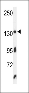 Western blot of ZO1 Antibody in K562 cell line lysates (35 ug/lane). ZO1 (arrow) was detected using the purified antibody.