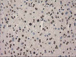 IHC of paraffin-embedded Human liver tissue using anti-PYCRL mouse monoclonal antibody.