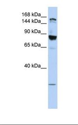 MCF7 cell lysate. Antibody concentration: 1.0 ug/ml. Gel concentration: 6-18%.