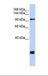 Jurkat cell lysate. Antibody concentration: 1.0 ug/ml. Gel concentration: 6-18%.