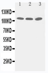 WB of TJP3 / ZO3 antibody. Lane 1: PANC Cell Lysate. Lane 2: A549 Cell Lysate. Lane 3: HELA Cell Lysate.